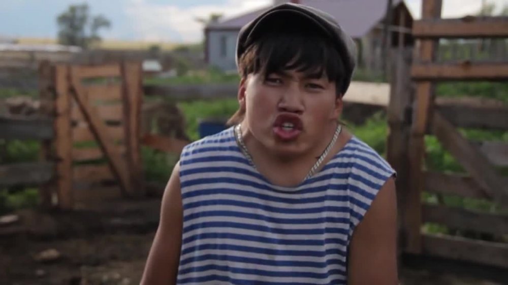 Синдром Клиппеля — Фейля фото