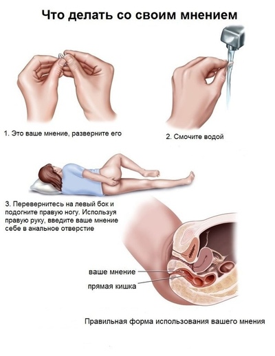 Чем промывать катетер в вене