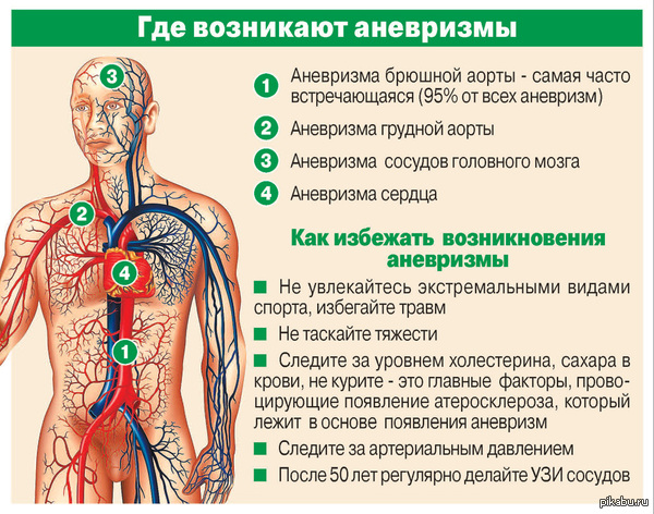 Аневризма в голове что это такое и как лечить Аневризма в голове что это такое и как лечить