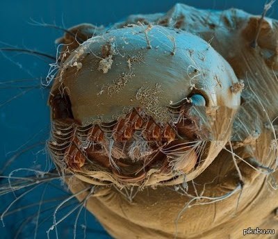 Микробы под онлайн через микроскоп микробов микроскопом: бактерии на ...