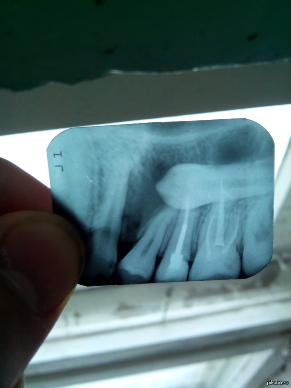 Я неудачник года