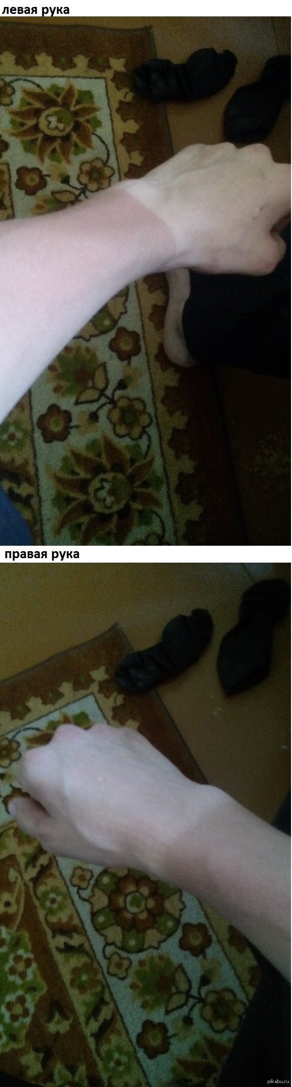 колол дрова в перчатках, вот результат