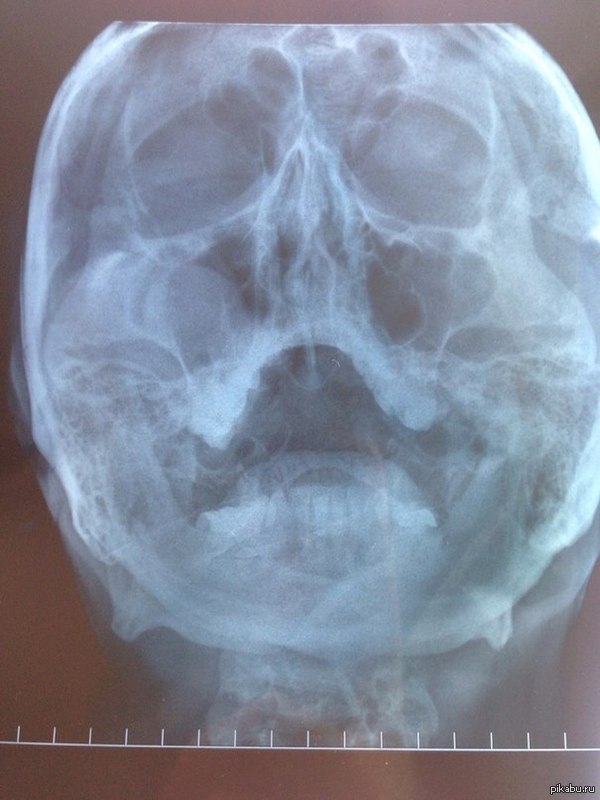 ���������� ����� � ��������������� ������