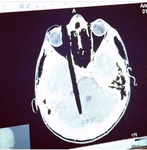 Вот так заставляют молчать или говорить то что нужно.