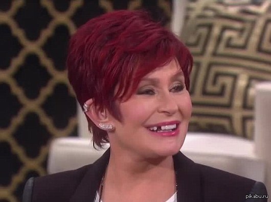 Lost a tooth live - Sharon Osbourne, Fail, Live, Dropped a tooth, Teeth, It happens