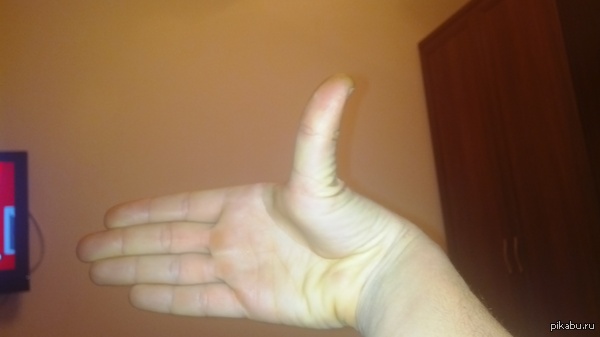 Еще один инвалид.