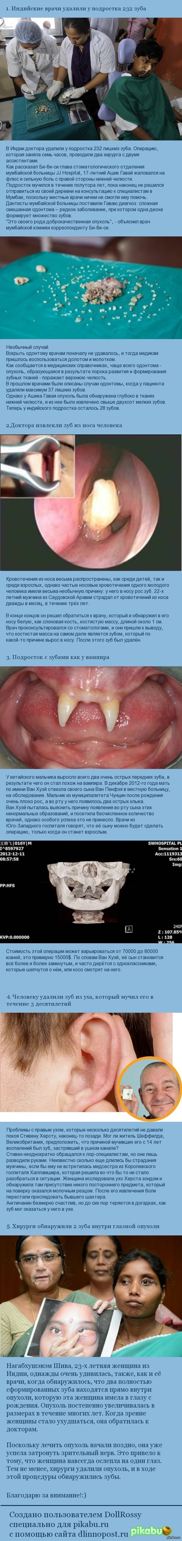 КОГДА ЗУБЫ НЕ НА СВОЕМ МЕСТЕ