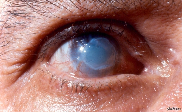 ����� �������� ���������������� ��������