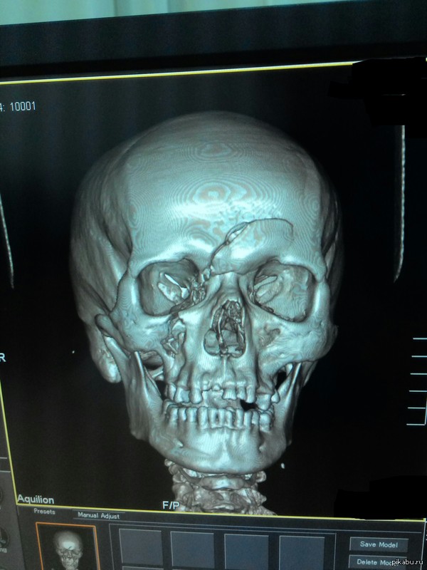 ������������ � ���������.