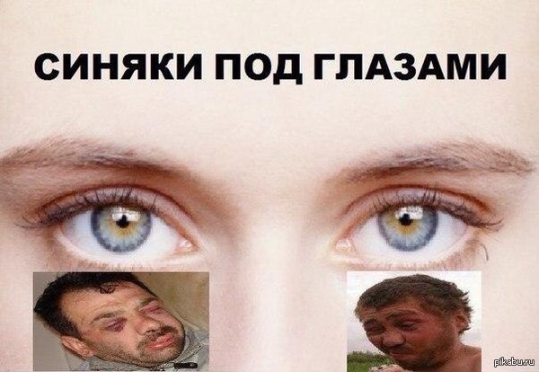 Синяки под глазами