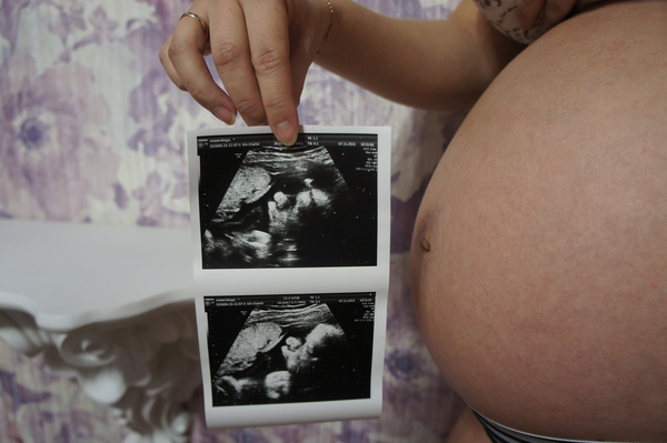 Про отцов и мудаков.