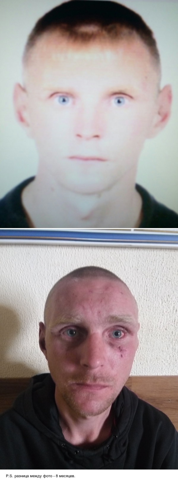 Как алкогольная зависимость, изменять внешность. | Пикабу