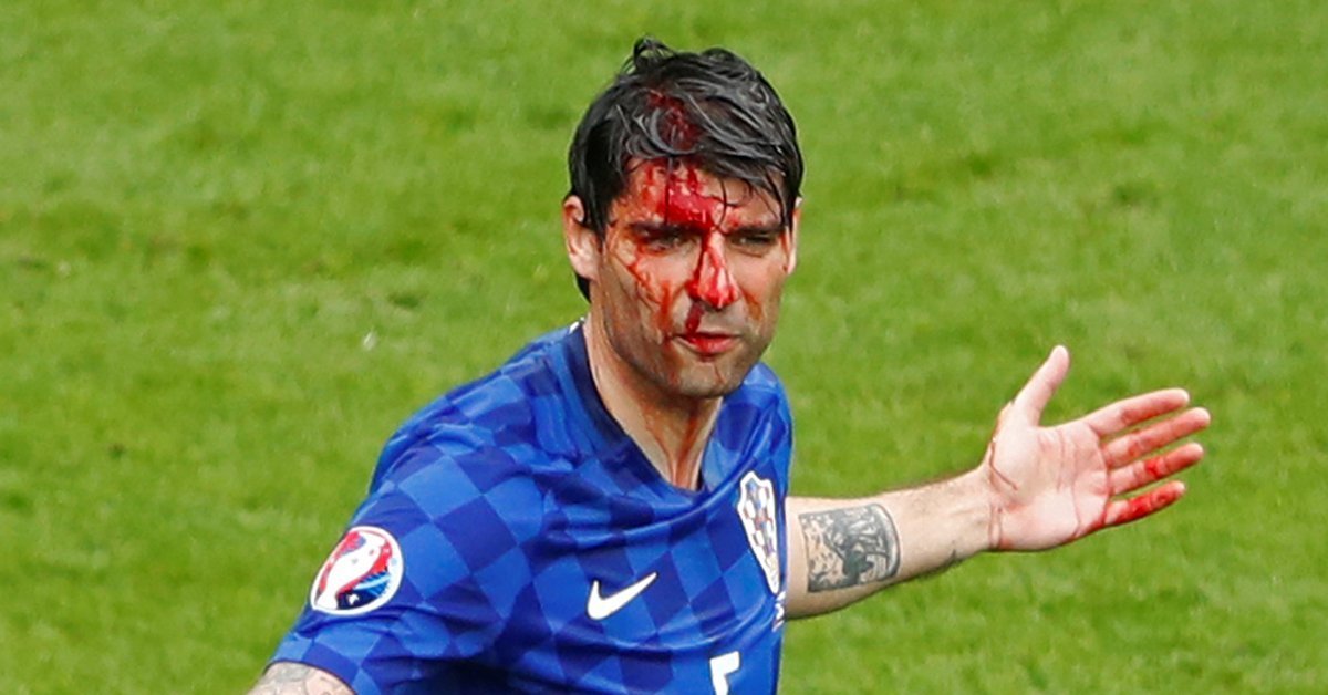 Разбившиеся футболисты. Английский футболист весь в крови. Игрок футбол весь в крови.