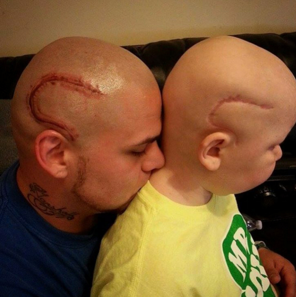 Отец сделал тату ,как шрам у сына. Вот это поступок!