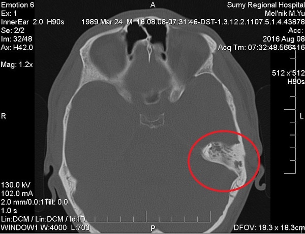 Не надо так, будь умнее #2 Уши, Здоровье, Отит, КТ