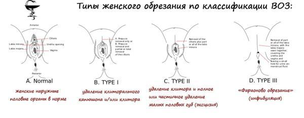 About the benefits of circumcision. - NSFW, Circumcision, Traditions, Conservatism, Danger, Longpost