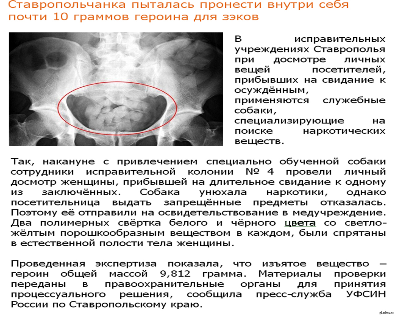 Stavropol woman tried to carry heroin inside herself - NSFW, Stavropol, Drugs, , Failure