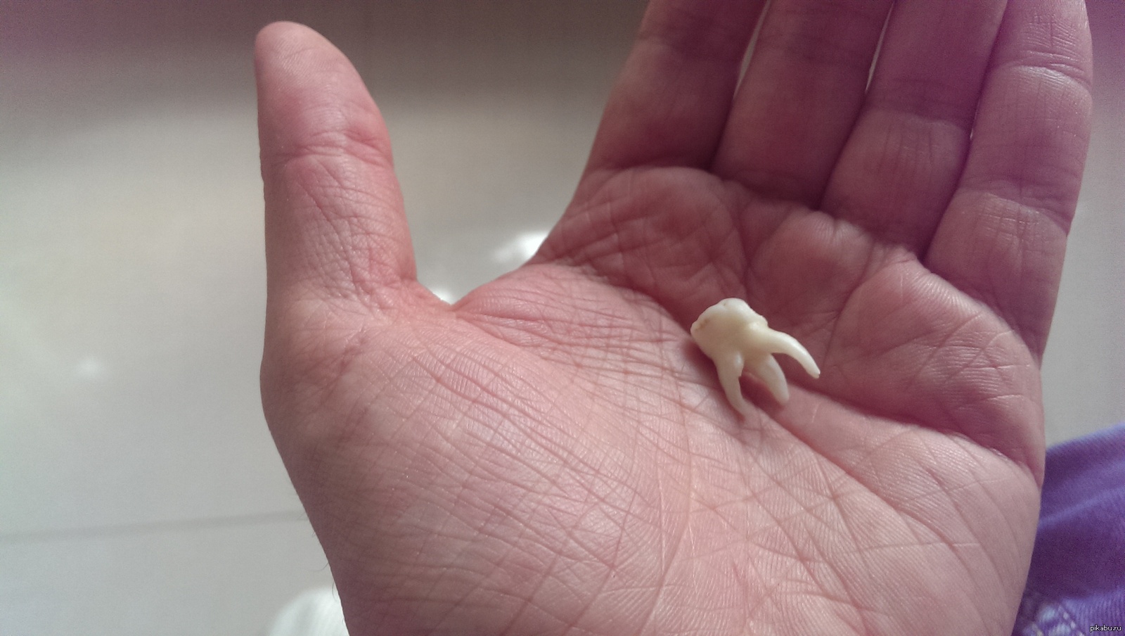 Молочная пятерка зуб. Молочный зуб с длинным корнем.