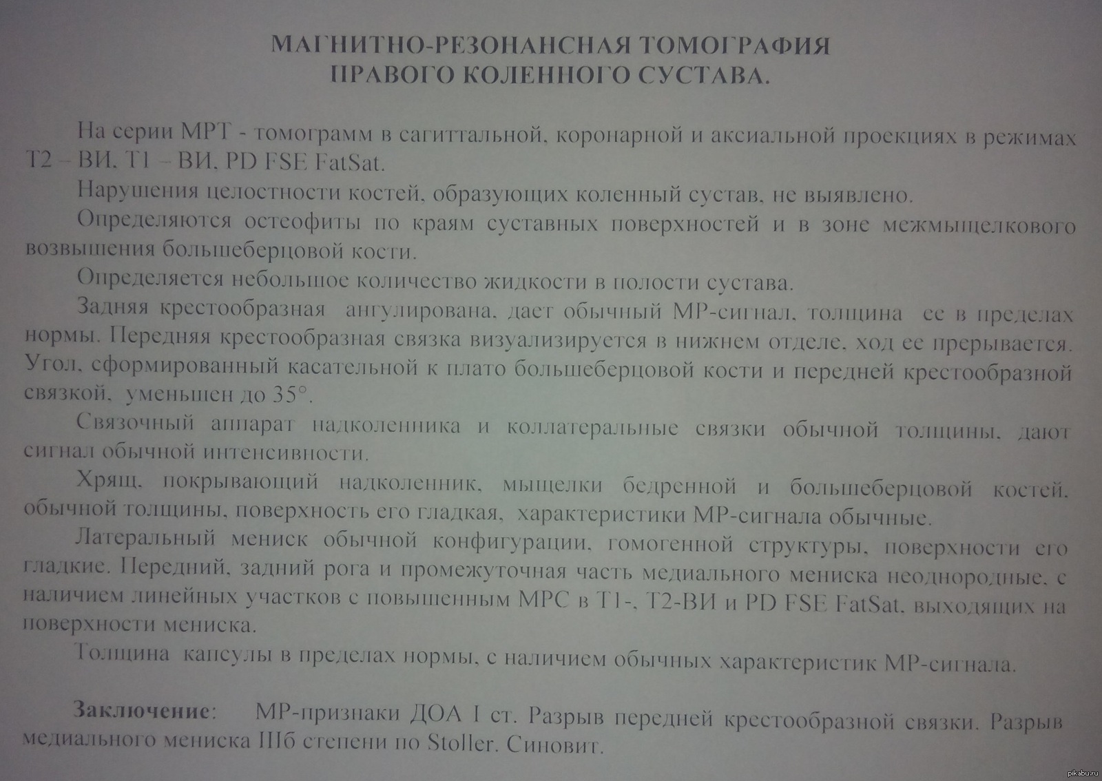 Прошу помощи травматологов! Не топите плиз. | Пикабу