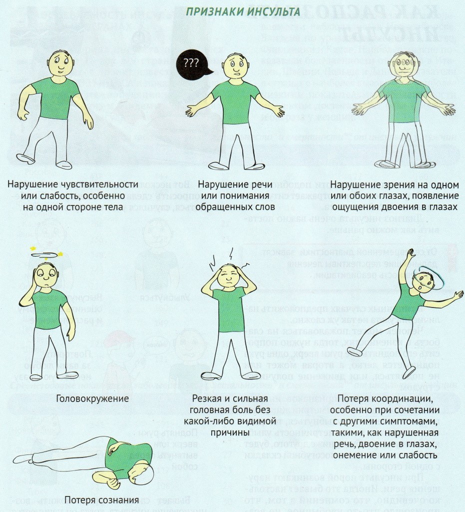 10 фактов об инсульте | Пикабу