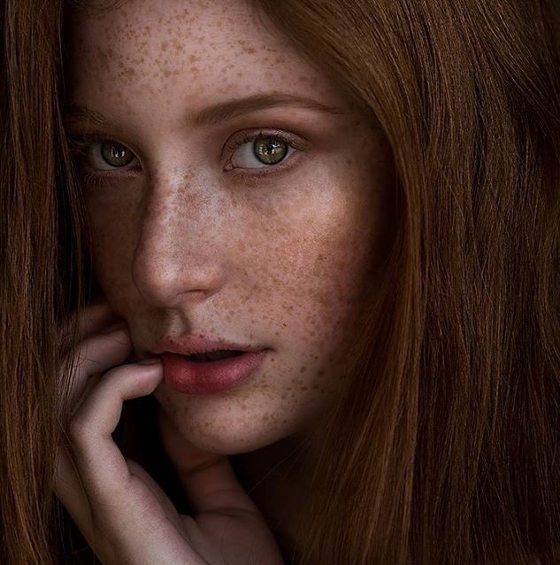 Freckled Girls Tumblr