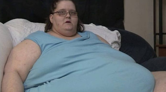 In Australia, a woman weighing 272 kg gave birth to an 18-kg baby - Childbirth, Record, news