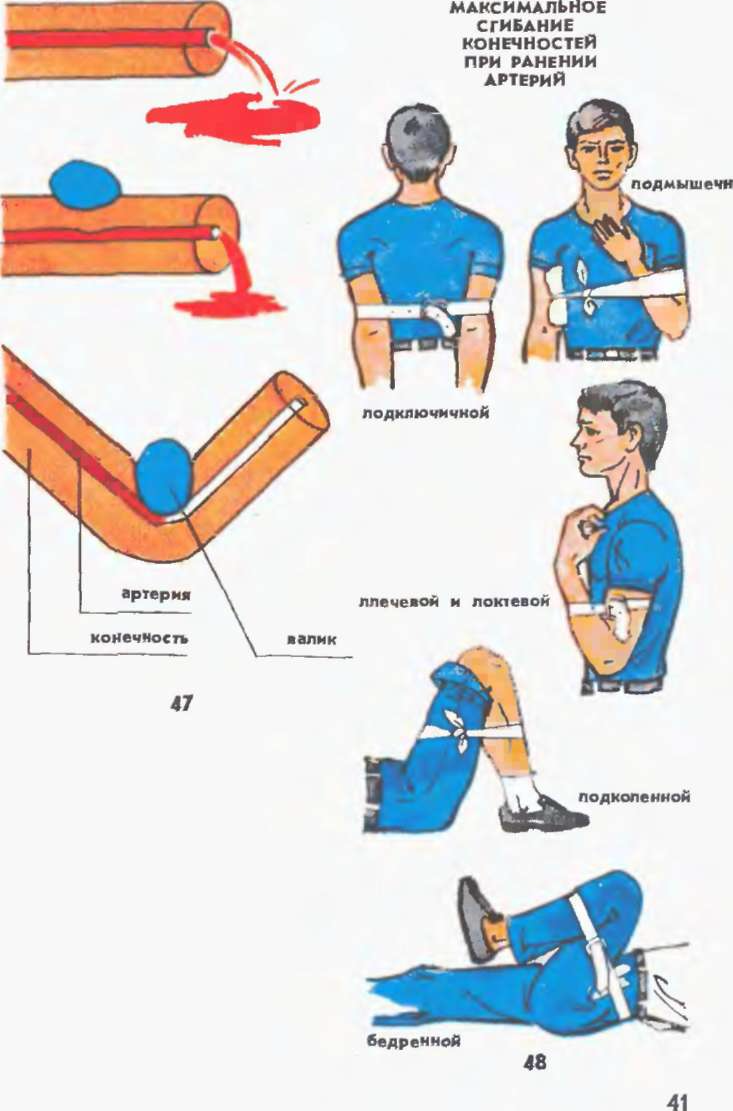 First Aid or how to wait for an Ambulance-16 - Harness, First aid, Bleeding, Longpost