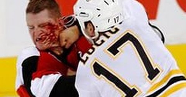 Самые драки в хоккее. Разбитое лицо хоккеиста. Хоккеист с разбитым лицом. Хоккей драка.